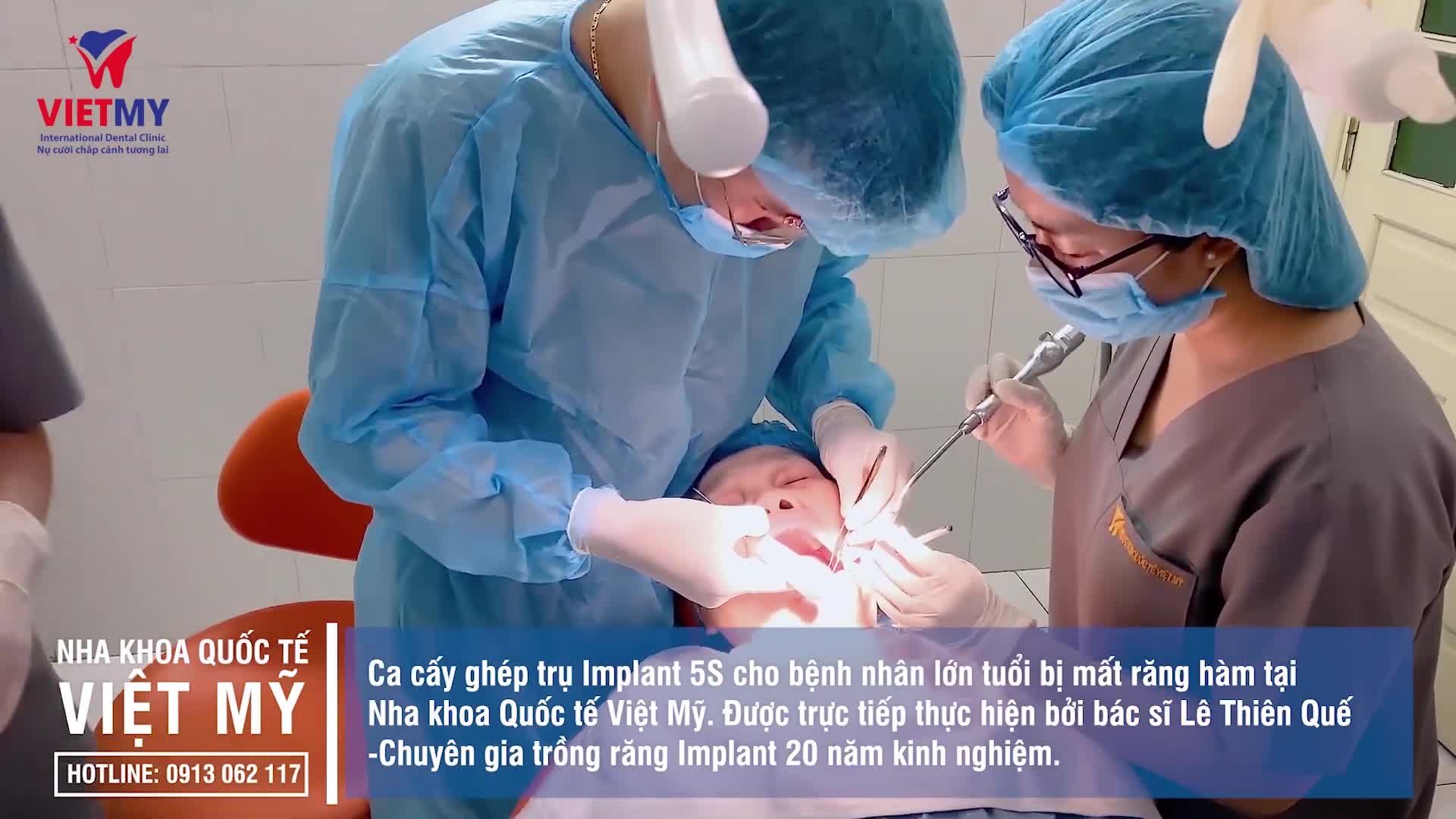 TRỒNG RĂNG IMPLANT 5S - GIẢI PHÁP HOÀN HẢO CHO NGƯỜI MẤT RĂNG