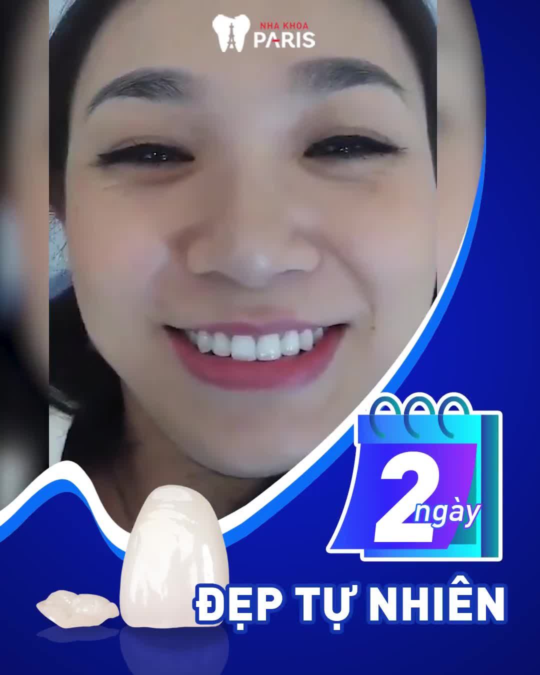 RĂNG XẤU HỎNG MUỐN ĐẸP NHANH
