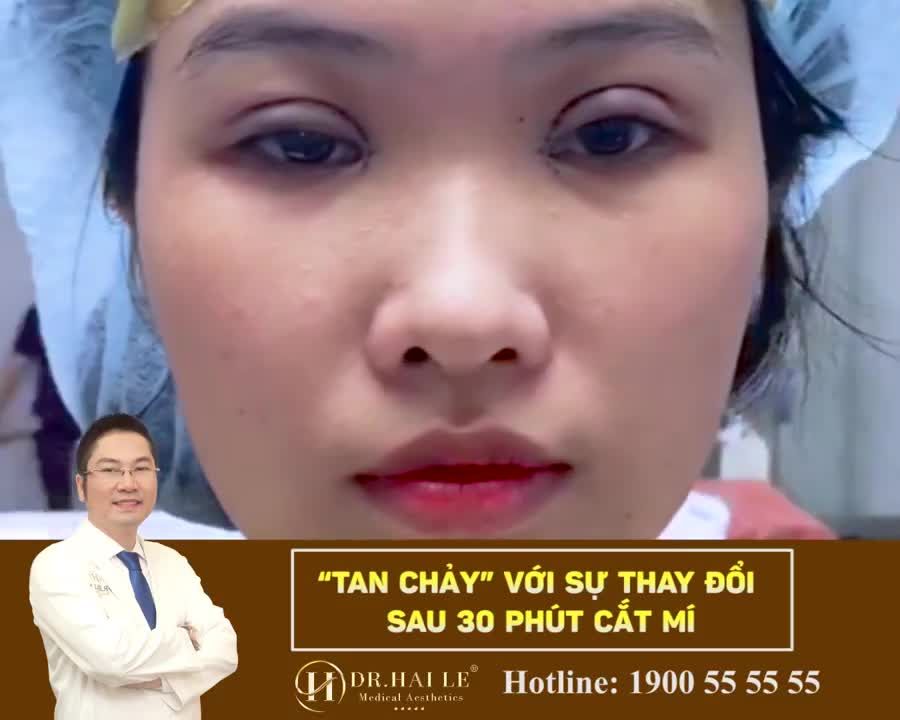 NẾP MÍ “SẮC NÉT” CHINH PHỤC MỌI CAMERA