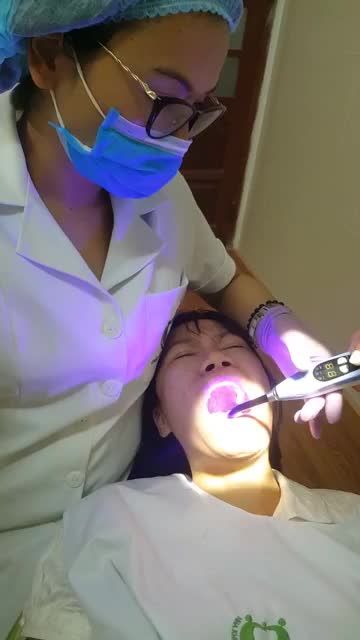 QUÁ TRÌNH BỌC 22 RĂNG SỨ CERAMILL TẠI CS3. 178 NGÔ GIA TỰ