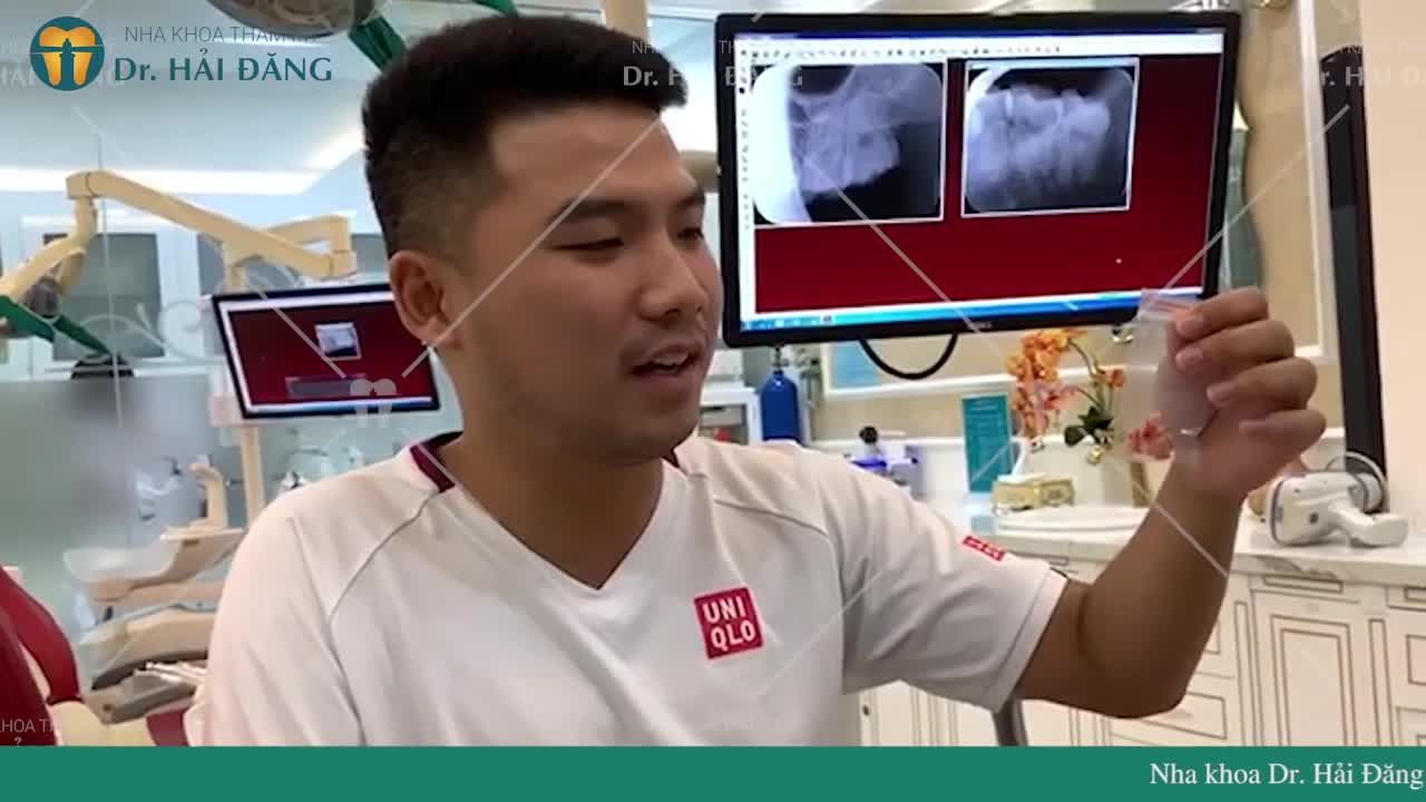 “Hoàn toàn thấy nhẹ nhàng, êm ái, không đau đớn gì cả” – đó lời chia sẻ của khách hàng Nguyễn Quang (Hà Nội).