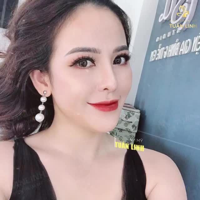 MŨI THẤP TẸT PHẢI LÀM SAO ĐÂY