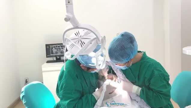 NHỔ 2 RĂNG KHÔN KHÔNG ĐAU KHÁCH HÀNG 17 TUỔI