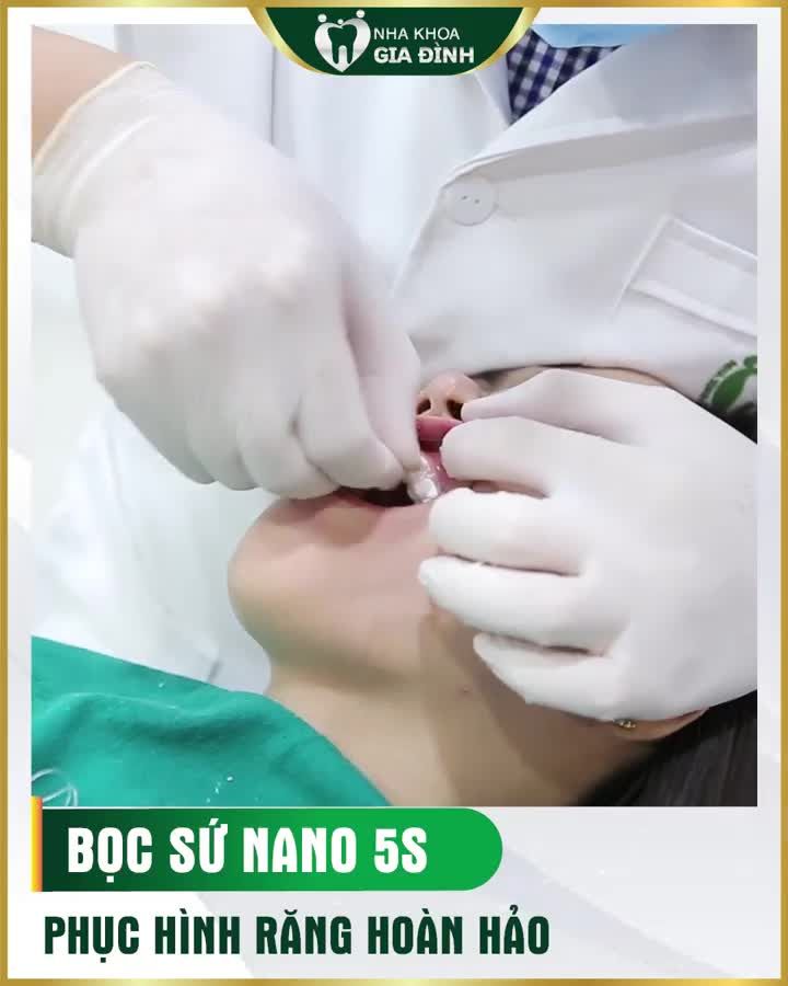 BỌC RĂNG SỨ NANO 5S – KHẮC PHỤC MỌI KHIẾM KHUYẾT RĂNG XẤU