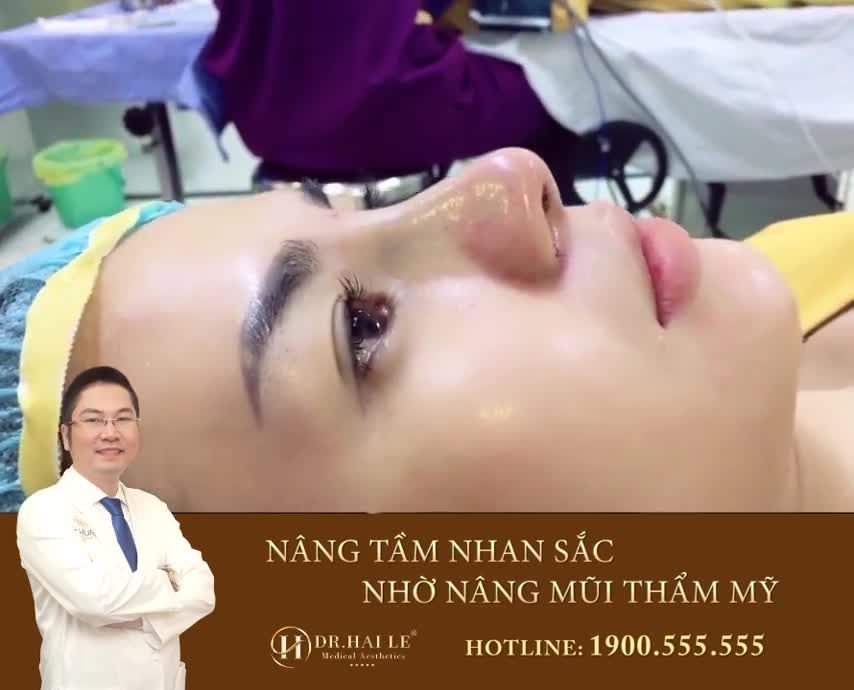 THĂNG HẠNG NHAN SẮC NHỜ NÂNG MŨI THẨM MỸ.!