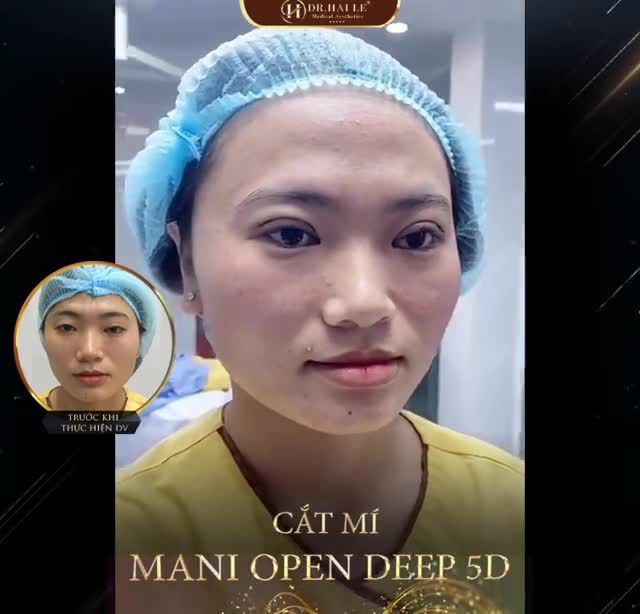 CẮT MÍ 1 TÍ TY MÀ ĐẸP MÊ LY