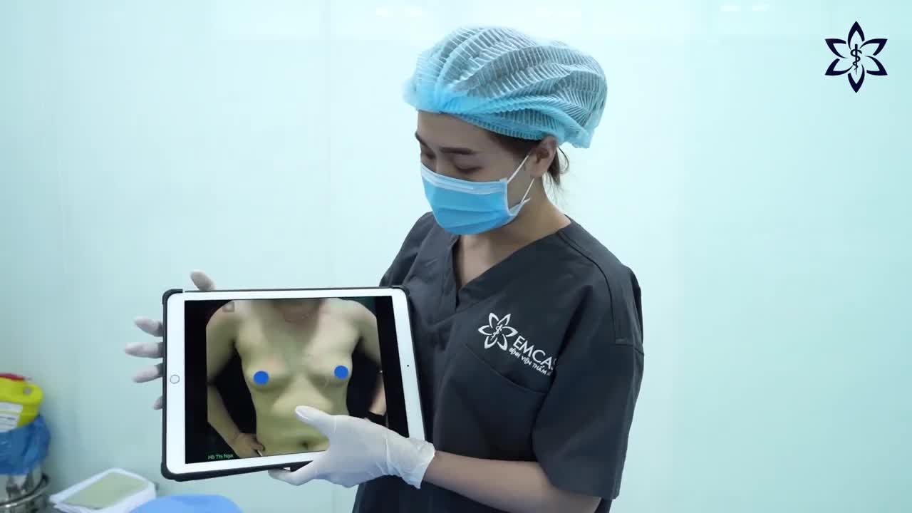 "BẤT NGỜ" VỚI CÁCH XỬ LÍ NGỰC LỆCH SIZE CỦA BÁC SĨ EMCAS VÀ KẾT QUẢ