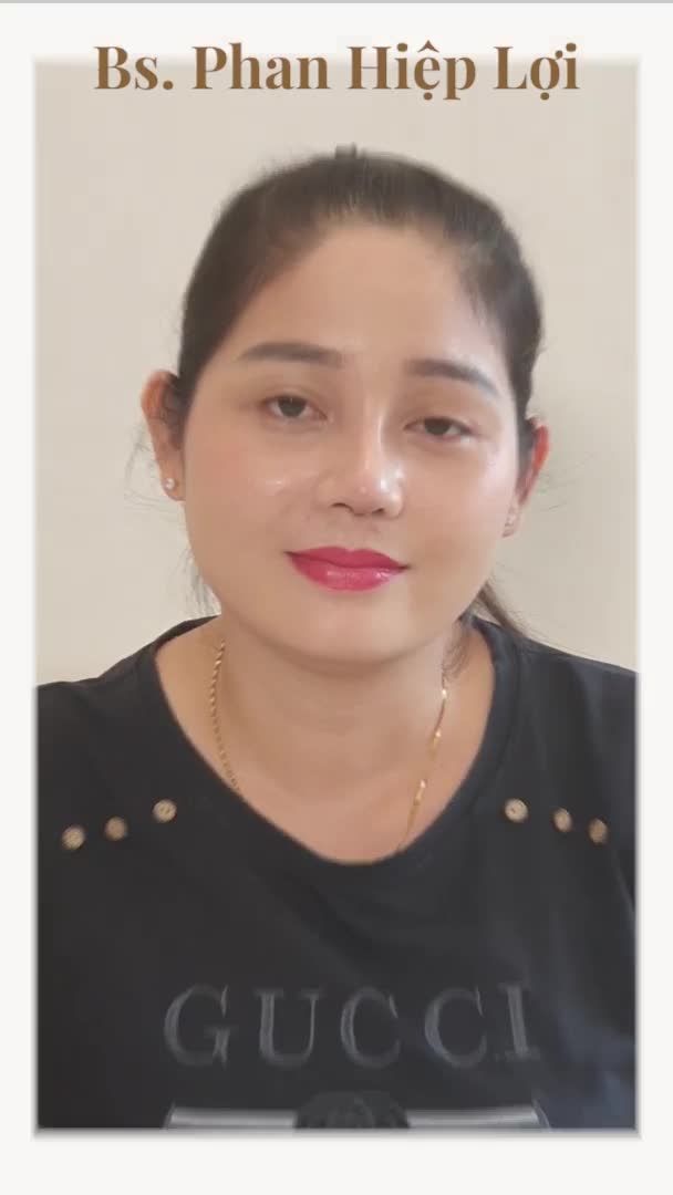 Một ca nâng mũi đẹp xuất thần chỉ sau 7 ngày tại bệnh viện Hiệp Lợi.