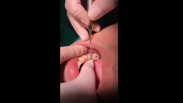 Những ưu điểm của phương pháp làm răng sứ qua chia sẻ trực tiếp của bác sỹ tại Shinbi