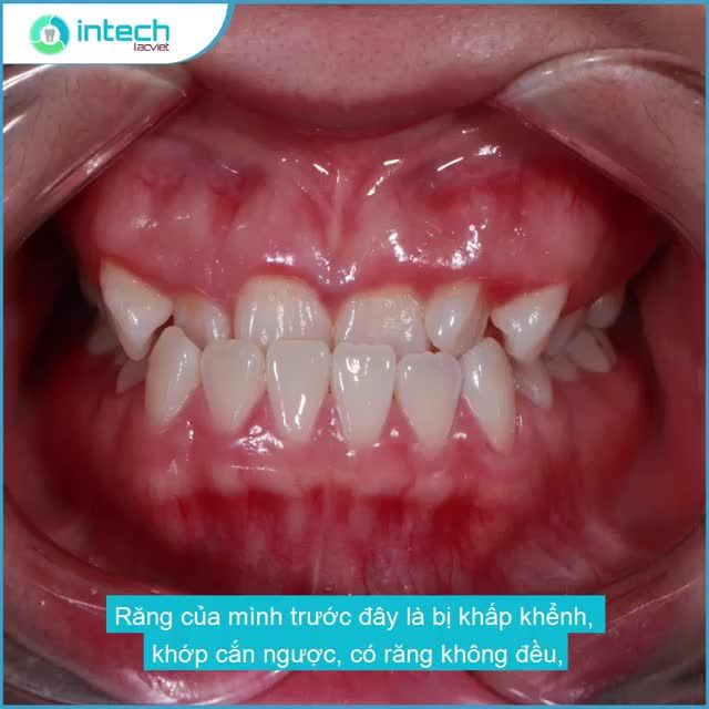 NỤ CƯỜI DUYÊN DÁNG - VẺ NGOÀI TỰ TIN