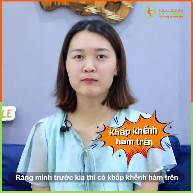 RĂNG KHẤP KHỂNH SAU 11 THÁNG THAY ĐỔI BẤT NGỜ