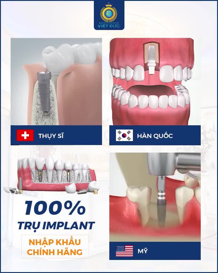 TRỒNG RĂNG IMPLANT ALL –ON – 4 TÁI SINH RĂNG MẤT – ĂN NGON TRỌN ĐỜI