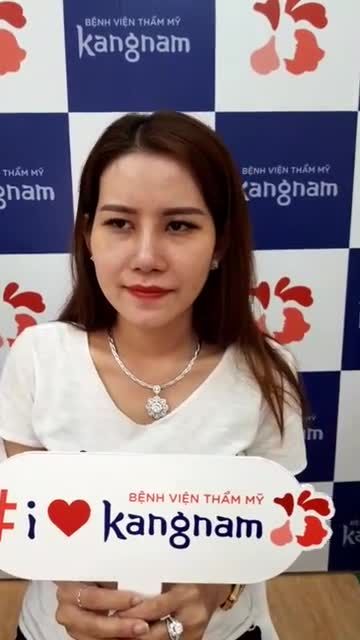 Tái khám Nâng mũi Cấu trúc 4D và thu gọn cánh mũi sau 10 ngày tại Kangnam