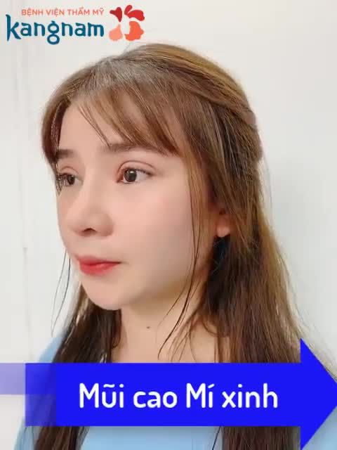 Combo NÂNG MŨI CẤU TRÚC + CẮT MÍ 10 ngày