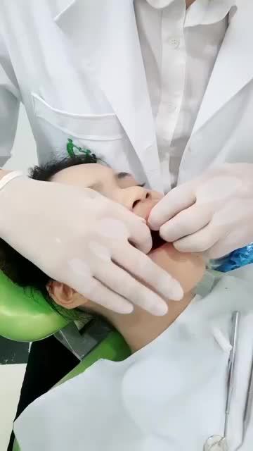 ĐỪNG ĐỂ MẤT ĐIỂM TRONG MẮT NGƯỜI ĐỐI DIỆN CHỈ VÌ HÀM RĂNG KHIẾM KHUYẾT TÂN TRANG NỤ CƯỜI VỚI PHƯƠNG PHÁP DÁN SỨ VENEER