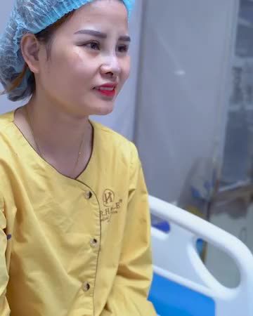 Kết quả nâng mũi tại Dr.Hải Lê - dáng mũi cao tự nhiên, hài hòa với khuôn mặt, đem lại cho bạn góc nghiêng hoàn hảo!