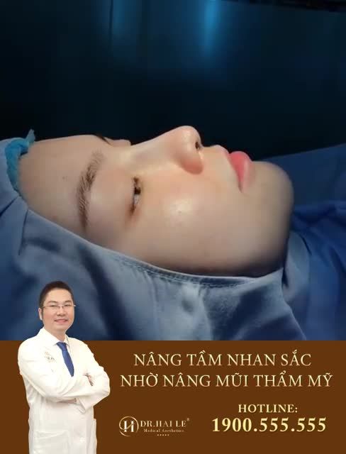 GÓC CẢNH BÁO: ĐỪNG DẠI DỘT ĐI NÂNG MŨI Ở DR HẢI LÊ KHI CHƯA ĐỌC BÀI VIẾT NÀY!