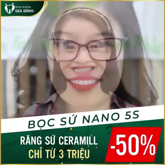THẨM MỸ RĂNG TẠI NHA KHOA GIA ĐÌNH ĐÃ LÀM NHẤT ĐỊNH PHẢI ĐẸP!