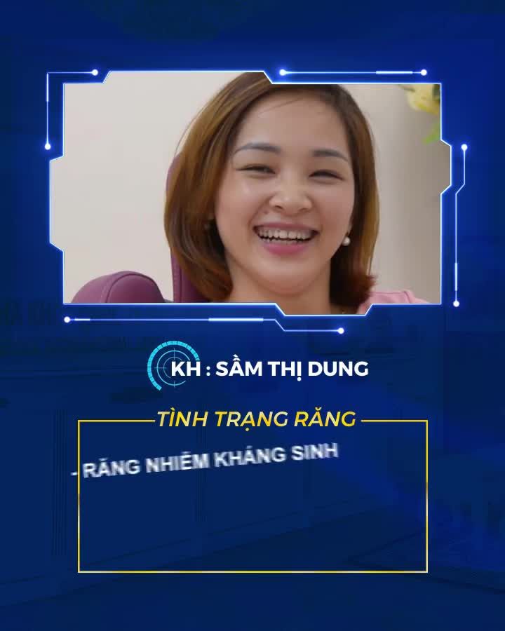 BỌC RĂNG SỨ NANO CERAMIC – RĂNG ĐẸP TRỌN ĐỜI CHỈ SAU 48H