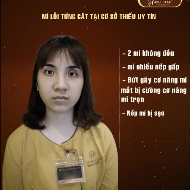 PHÂN BIỆT: CẮT MÍ "SIÊU KHÓ" MK VÀ SỬA MÍ "DEEP TECH20". Giải pháp nào dành cho bạn ??