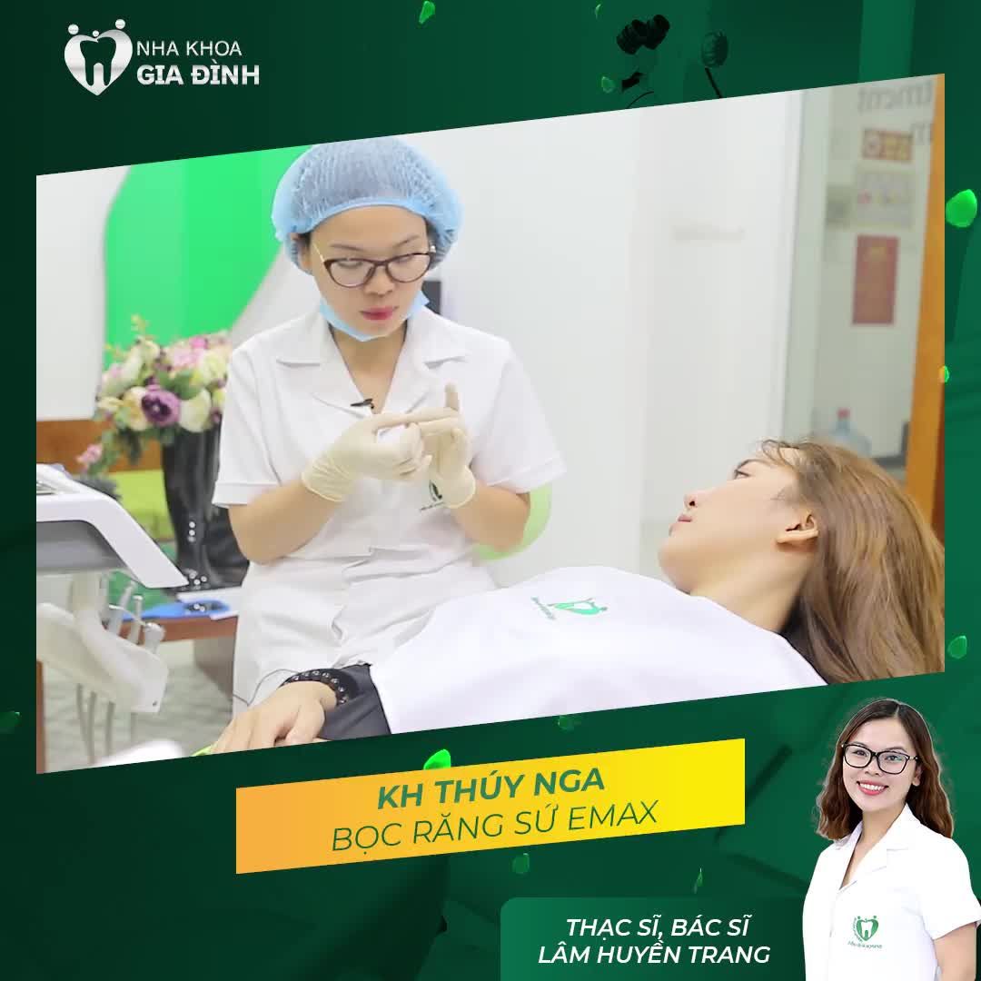 BỌC RĂNG SỨ E.MAX MẪU ẢNH THÚY NGA HÀI LÒNG TUYỆT ĐỐI VỀ NỤ CƯỜI MỚI