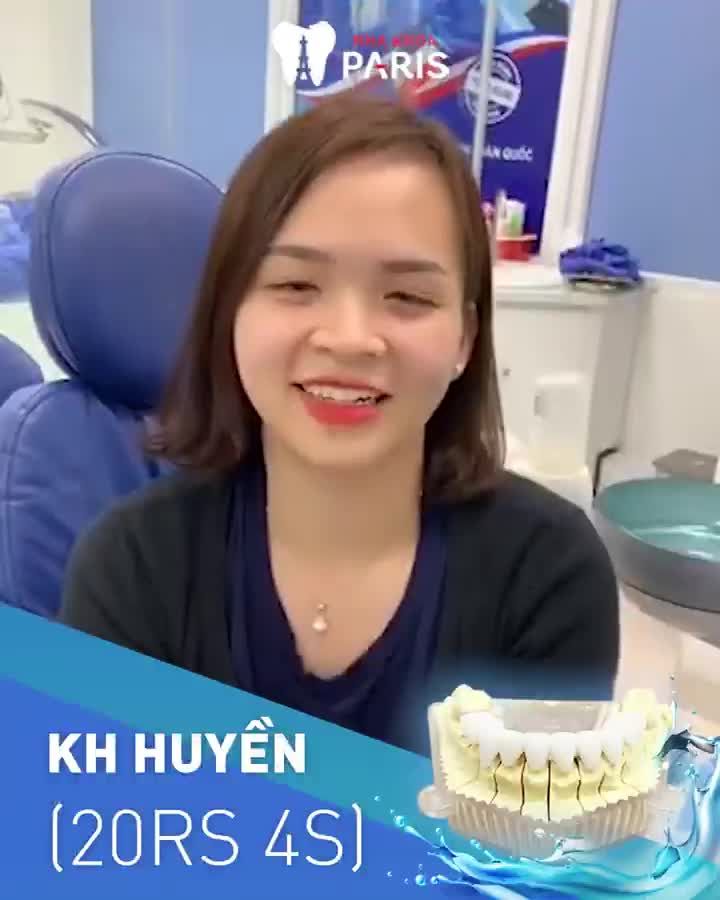 Răng Thưa- Răng Nhiễm Màu- Sứt Mẻ Mất Tự Tin?
