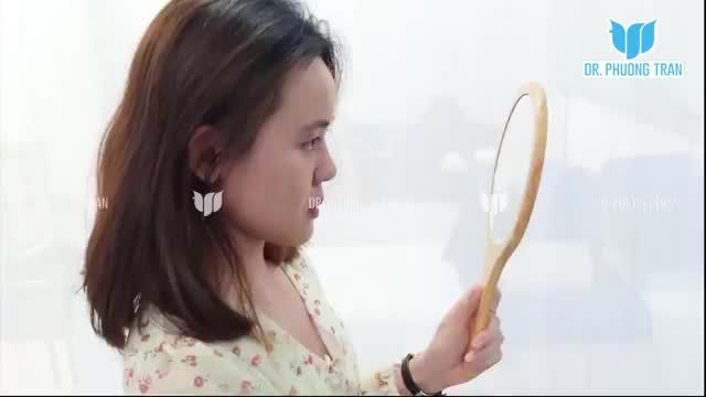 Dáng mũi cấu trúc đẹp tự nhiên sau 8 ngày