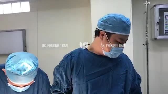 Sự công phu của một ca phẫu thuật mũi sụn sườn