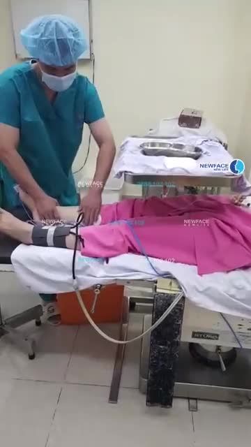 Toàn bộ quá trình nâng mũi cấu trúc bằng sụn sườn: chuẩn bị gây mê, lấy sụn sườn và phẫu thuật mũi của ekip bác sĩ