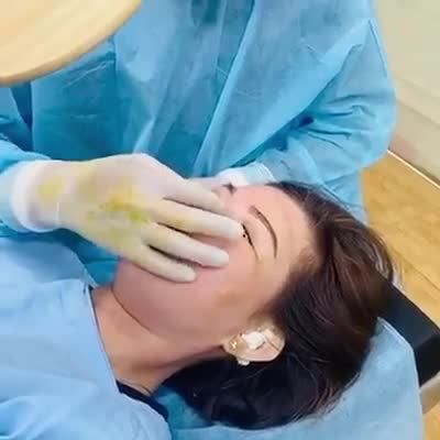 Bạn muốn nâng mũi nhưng lại sợ hư mũi vì bạn lại thích "ngoáy mũi" hay bạn bị người iu véo mũi.