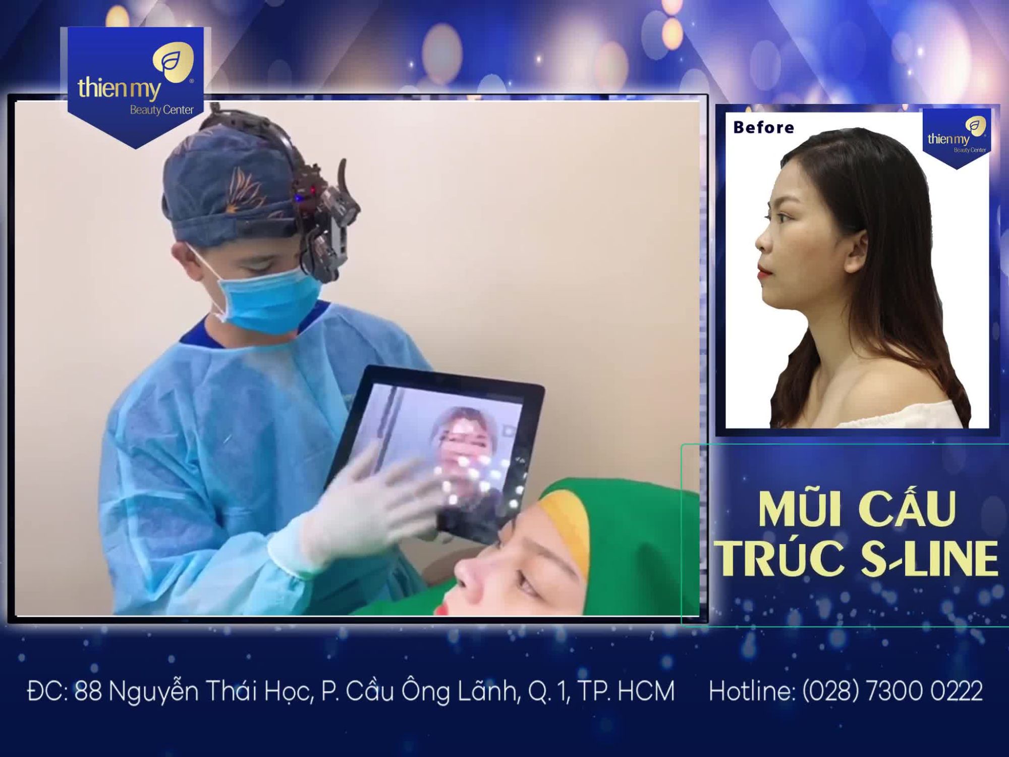 DÁNG MŨI KHIẾN MỌI CÔ GÁI MÊ MẨN