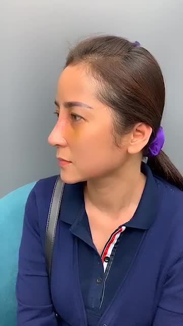 Đầu mũi tròn dài nhưng thiếu sóng thì phải làm sao?