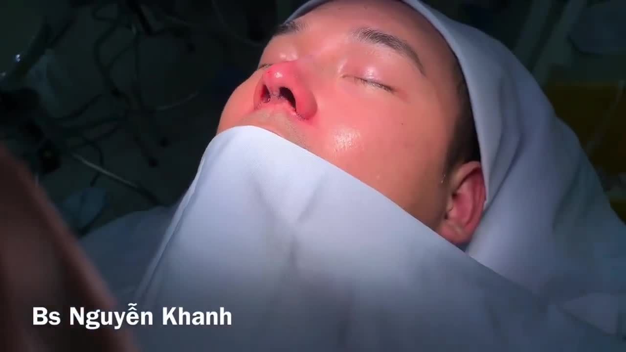 Mọi người vote xem Bs Khanh có nên tự xoa dịu nỗi đau bằng 1 chiếc mũi thật hoành tráng không ạ