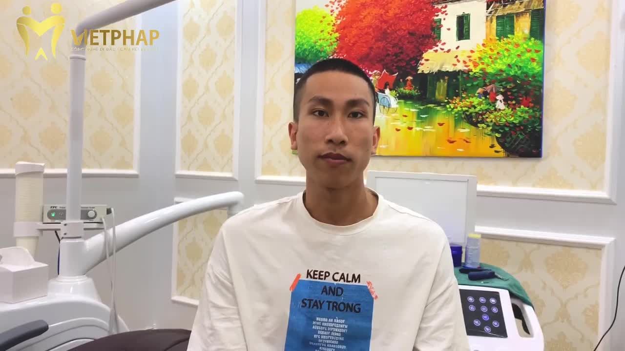 NHỔ RĂNG KHÔN SỐ 8 KHÔNG ĐAU CHỈ TRONG TÍCH TẮC