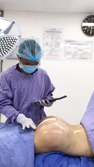 Thành quả sau khi nâng mông của khách hàng tại bệnh viện Thẩm Mỹ Đông Á