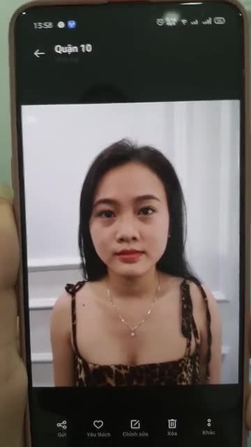CA NÂNG MŨI CẤU TRÚC ĐẸP NGAY KHI LÀM, BẠN GÁI QUÁ BẤT NGỜ!!!