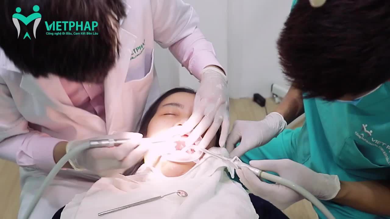 ĐEO HÀM RĂNG TẠM LÀ GÌ