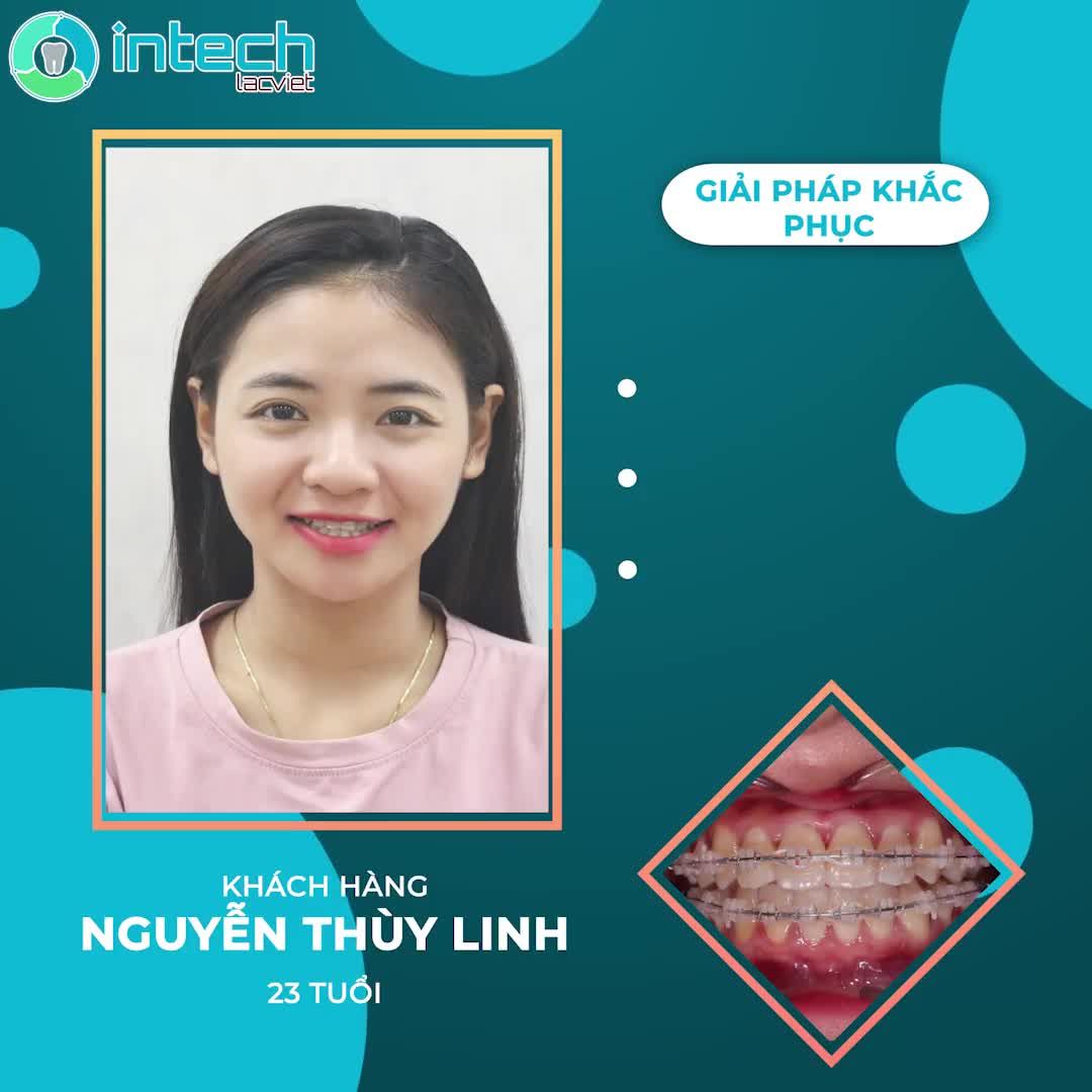 GƯƠNG MẶT THANH TÚ - NỤ CƯỜI RẠNG NGỜI