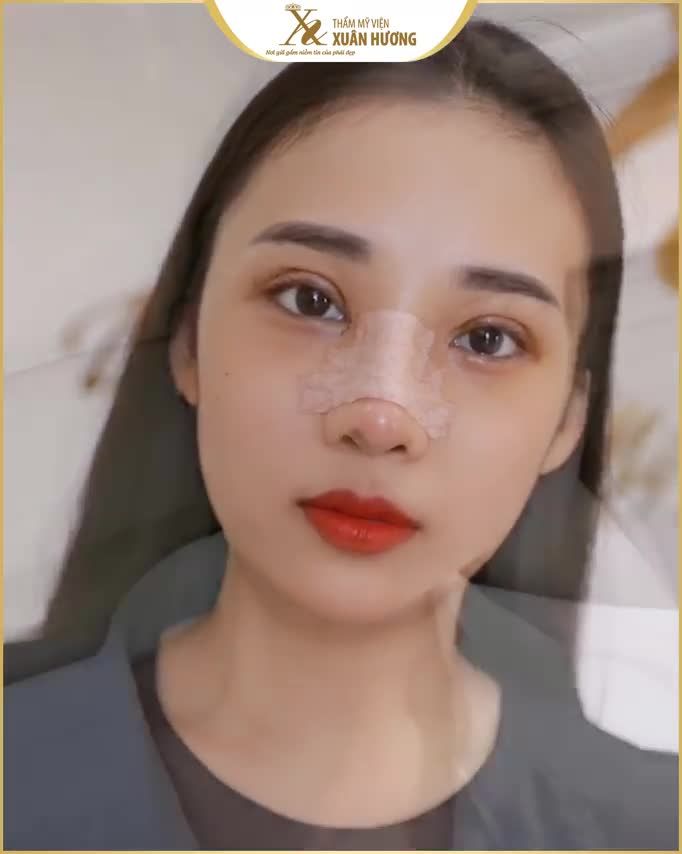 "MŨI" - BỘ PHẬN QUYẾT ĐỊNH 90% THẦN THÁI GƯƠNG MẶT!