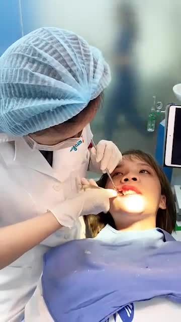 Cận cảnh quy trình cắt thép sau phẫu thuật chỉnh hình hàm mặt tại Kangnam - sau 1 tháng phẫu thuật