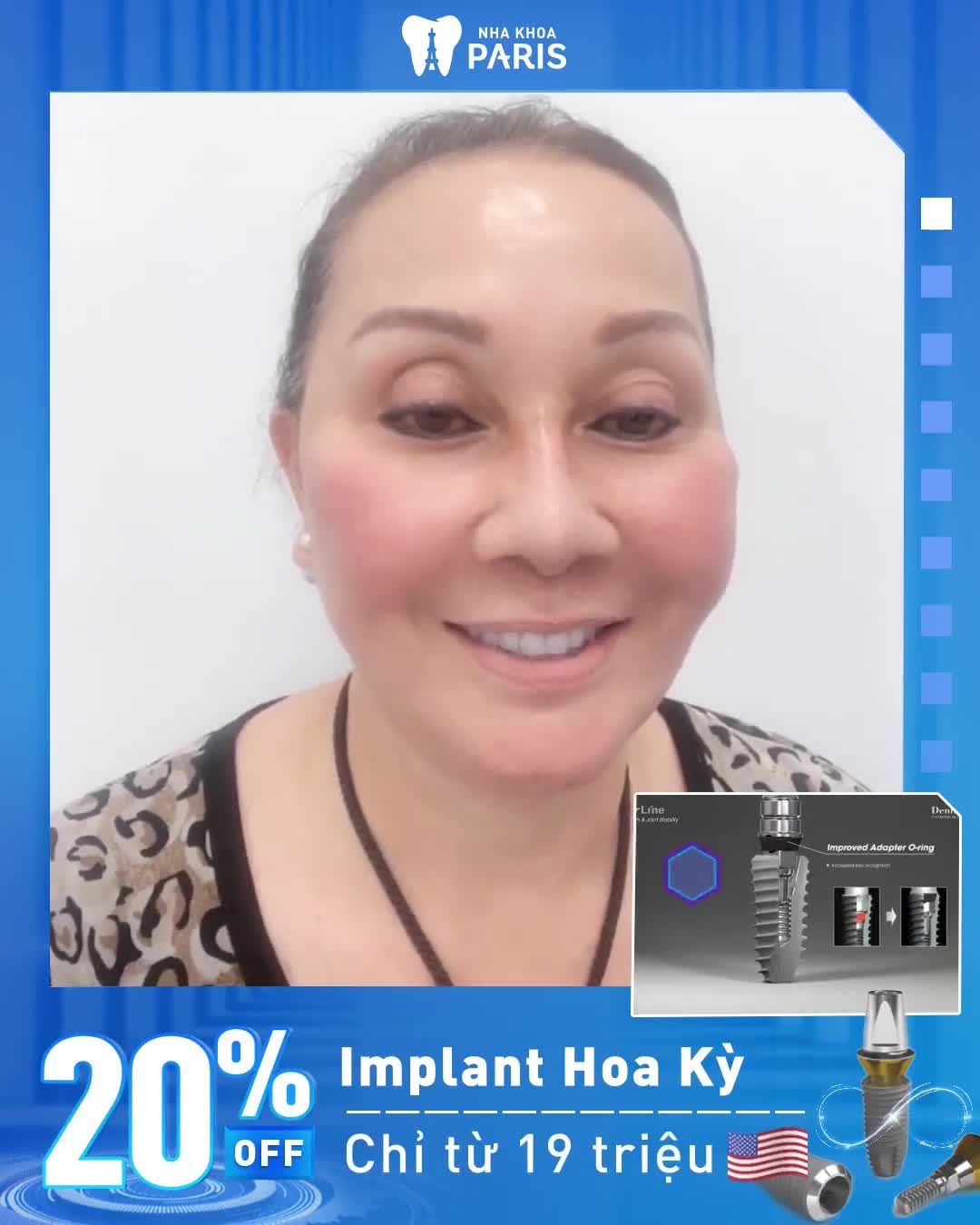 TRỒNG RĂNG IMPLANT GIÁ TỐT NHẤT NĂM