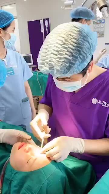 Bác sĩ tiếp tục tục thực hiện nhấn mí cho ca mí số 72/8 sau khi nâng mũi cấu trúc Pureform.