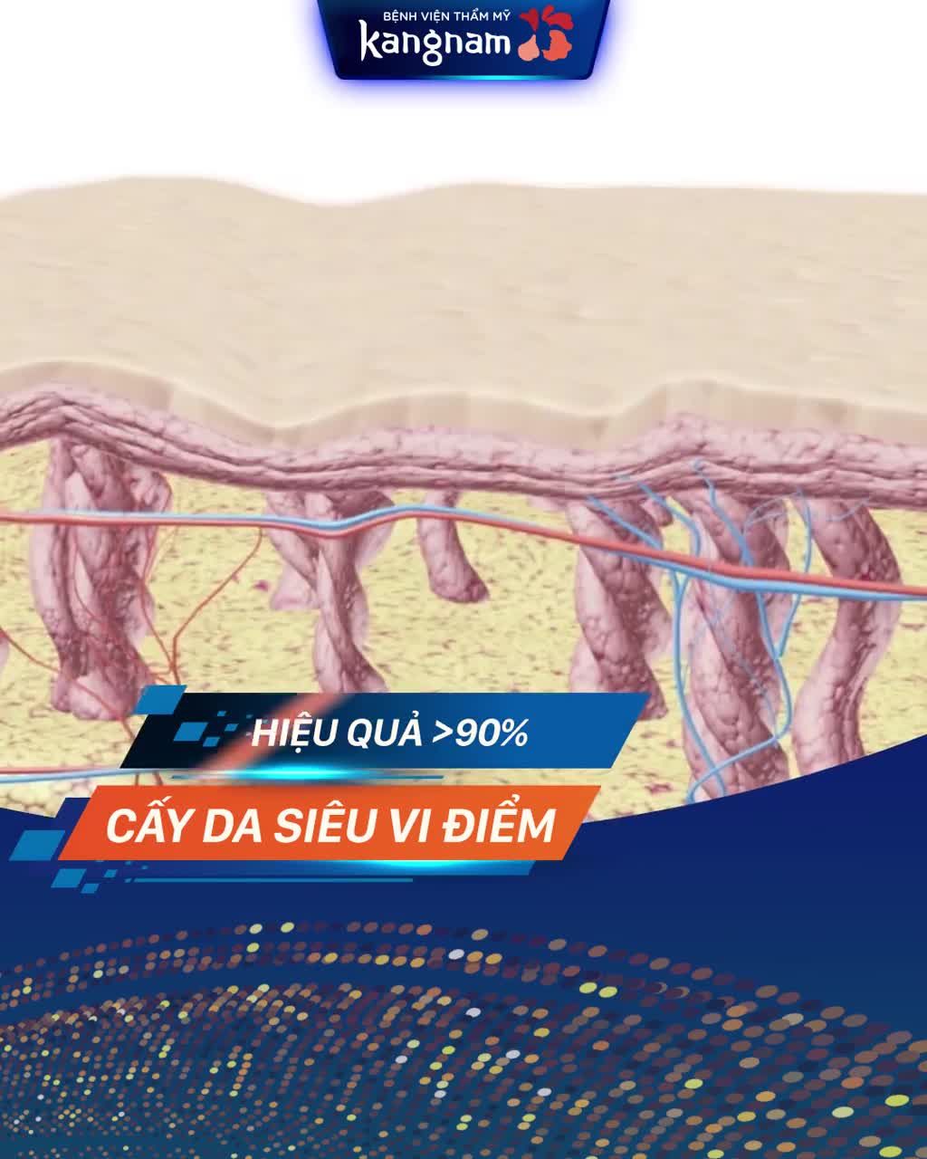 Cấy da siêu vi điểm - Công nghệ đặc trị SẸO LÕM/ RỖ