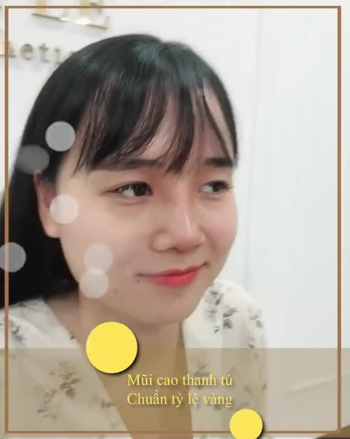 NÂNG MŨI MỘT LẦN - ĐẸP TRỌN MỘT ĐỜI.!