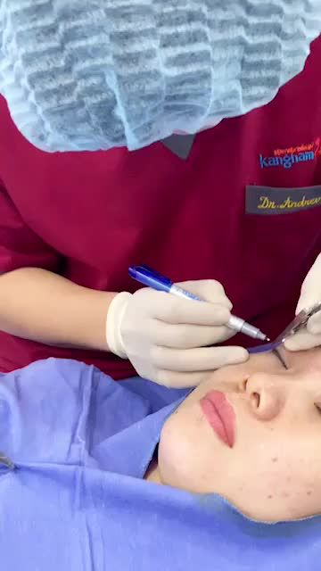 Chỉ CẮT MÍ + NÂNG MŨI có ĐỦ LỘT XÁC?