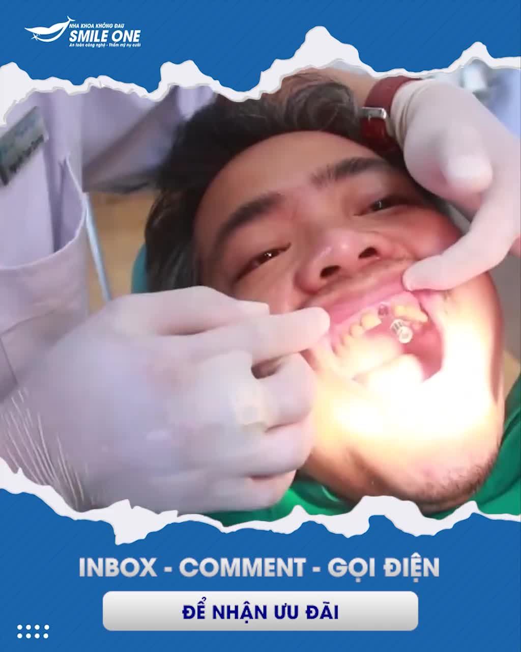 CƠ HỘI NHẬN SUẤT CẤY IMPLANT MIỄN PHÍ