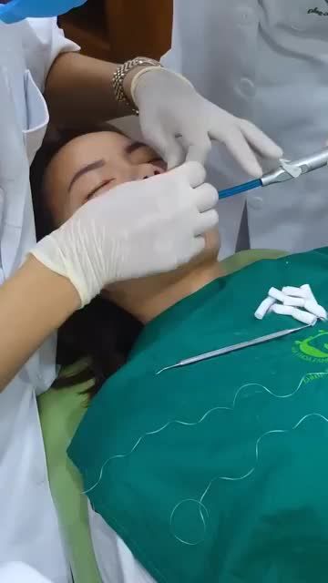 DÁN SỨ VENEER- TRỰC TIẾP THỰC HIỆN CHUYÊN GIA TRÊN 15 NĂM KINH NGHIỆM