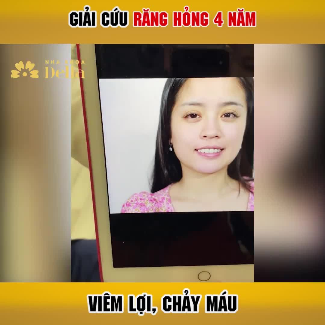 KHÁCH HÀNG PHƯƠNG HOA GẶP TÌNH TRẠNG