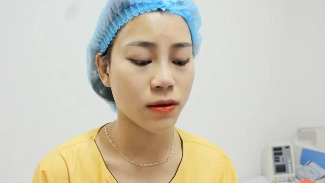 GIẢI TỎA lo lắng nâng mũi sợ đau, nâng mũi sợ không như mong muốn, nâng mũi phá tướng ...