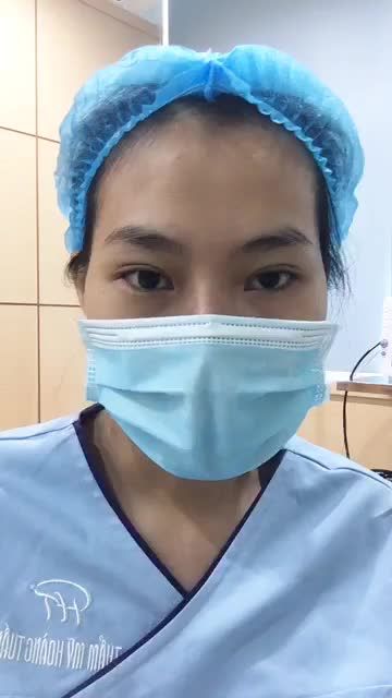 Cắt mí trên kết hợp ghép mỡ sẽ thay đổi nếp mí của khách hàng như thế nào?